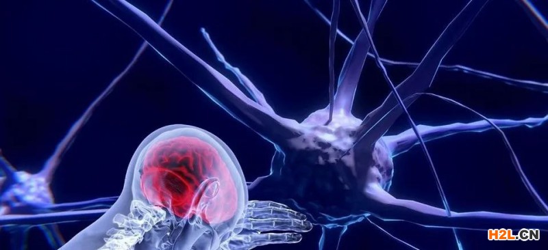 神經(jīng)網(wǎng)絡模型專利權利要求應該如何布局? 